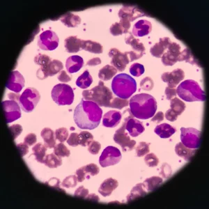 Leucemia felina virus